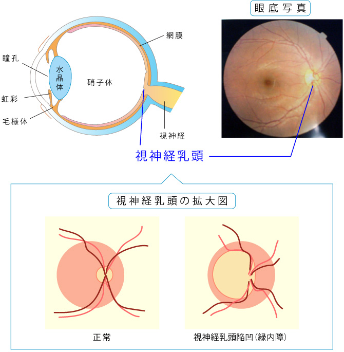 OCTは万能なのか